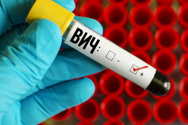 В Брянской области на треть выросла выявляемость ВИЧ-инфекции