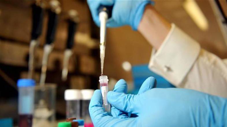 В Брянской области лабораторно подтвержден первый в этом сезоне случай свиного гриппа