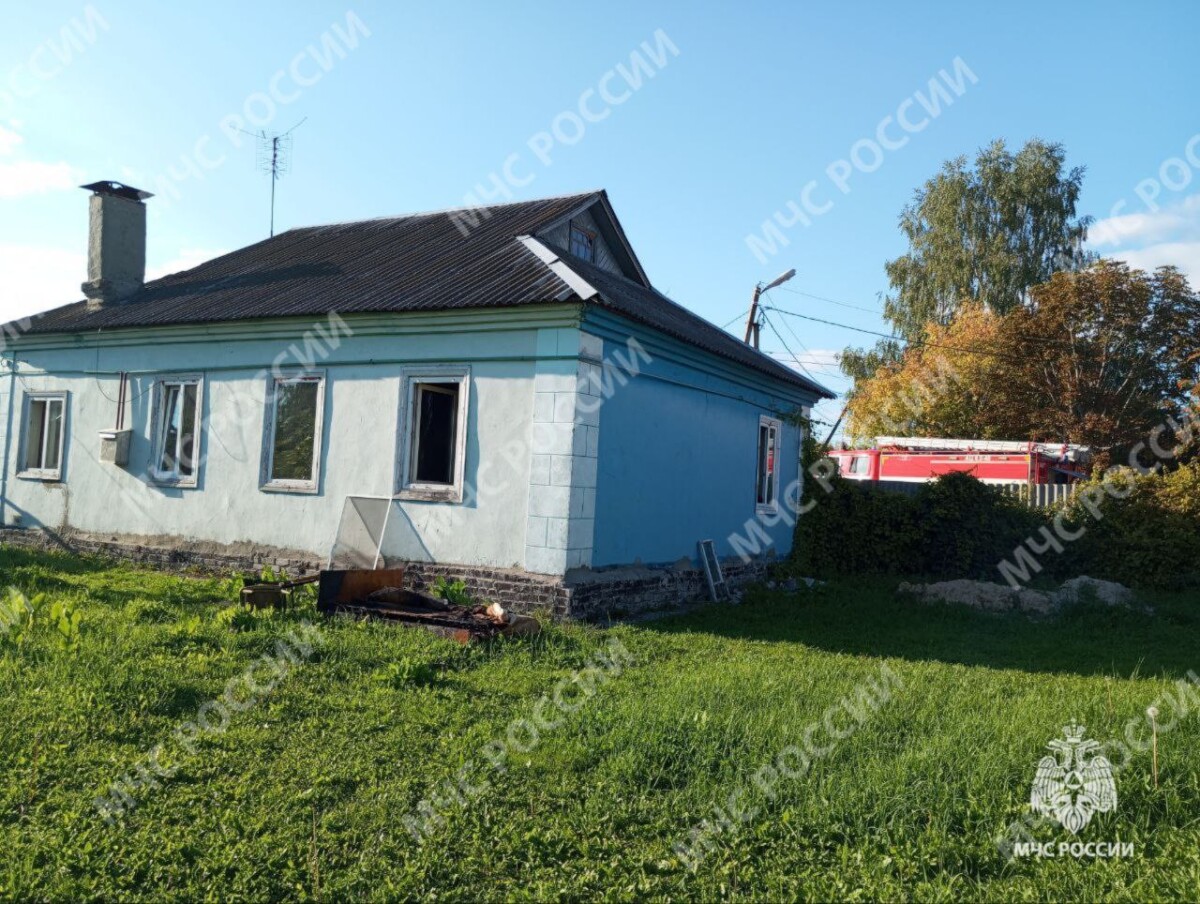 Хозяйка дома получила ожоги в Карачеве