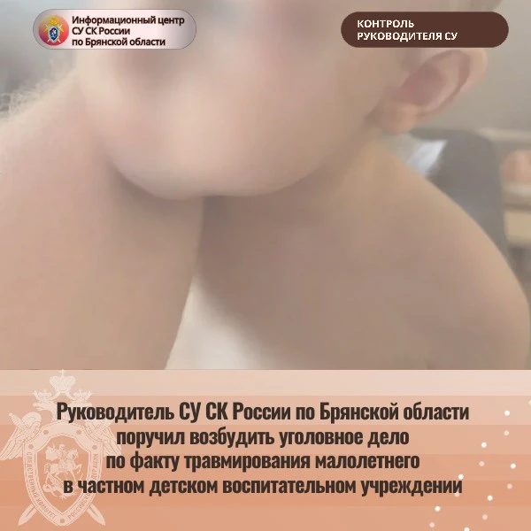 В детсаду Брянска травмирован мальчик, говорят, случай не единичный